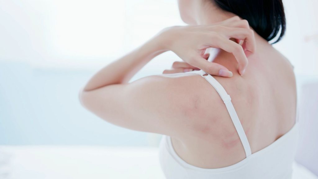 woman itching a rash