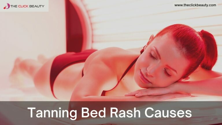 tanning-bed-rash-causes-and-best-remedies-in-2023