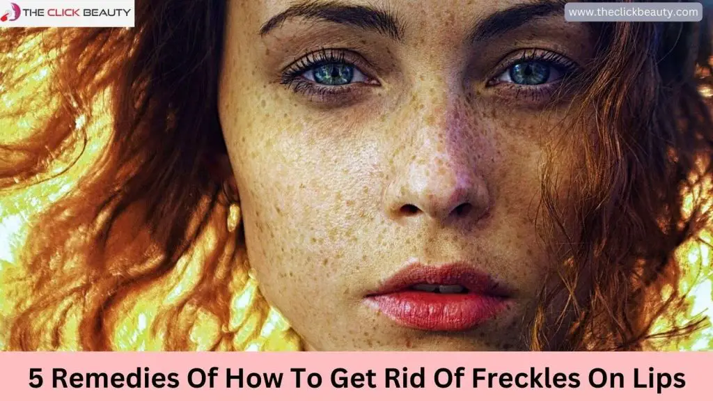 Get Rid Of Freckles On Lips