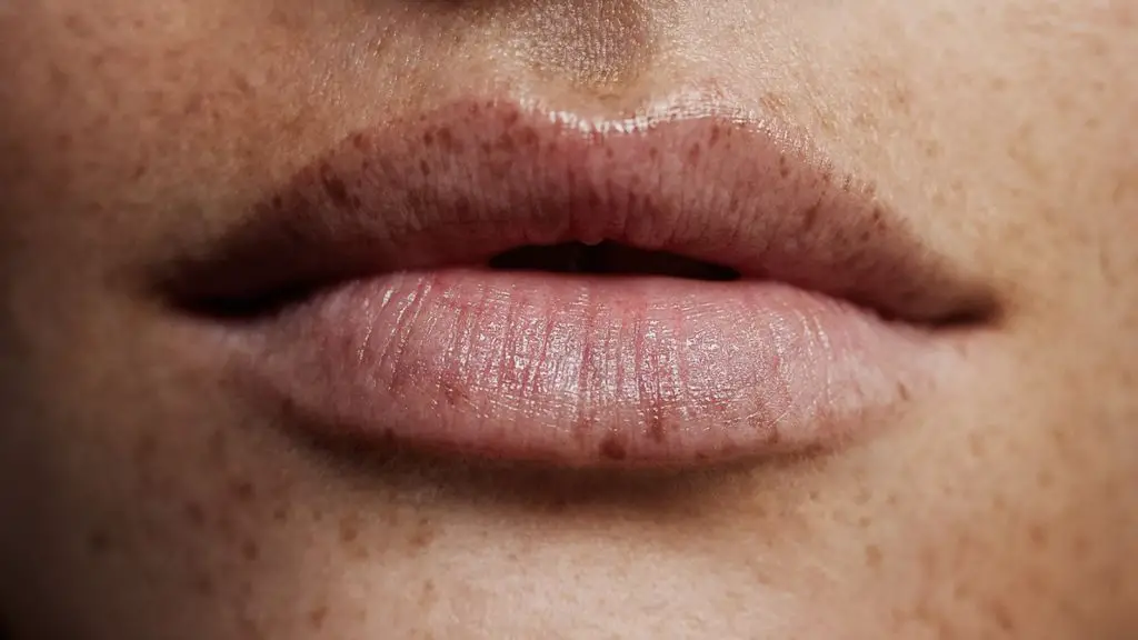 best way to Get Rid Of Freckles On Lips