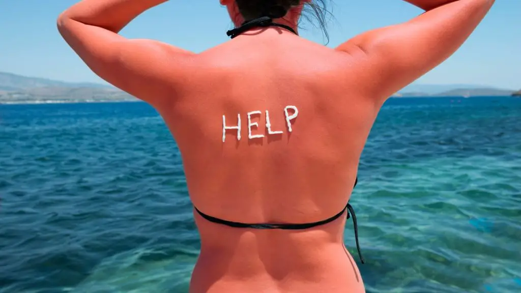 Sunburned woman asking for help